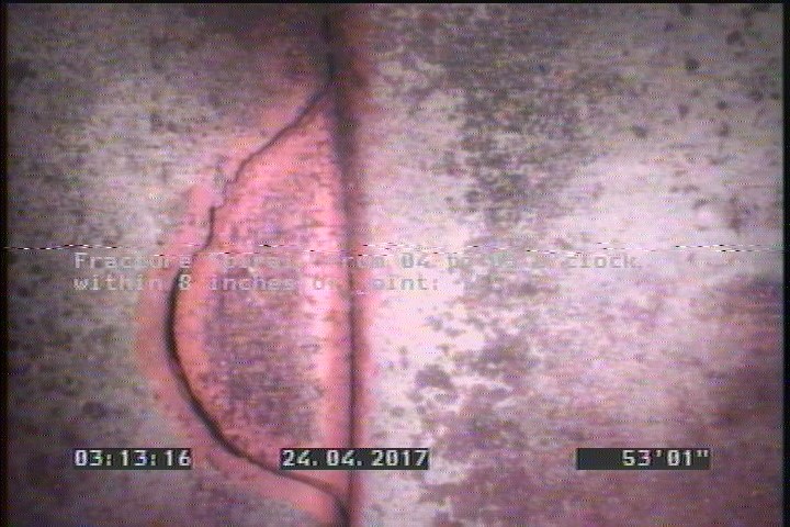 Fracture Spiral, from 04 to 05 o'clock, within 8 inches of joint: YES