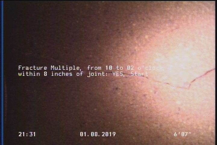 Fracture Multiple, from 10 to 02 o'clock, within 8 inches of joint: YES, Start