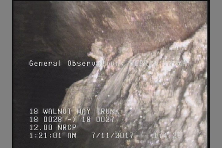 General Observation - DEBRIS IN MH
