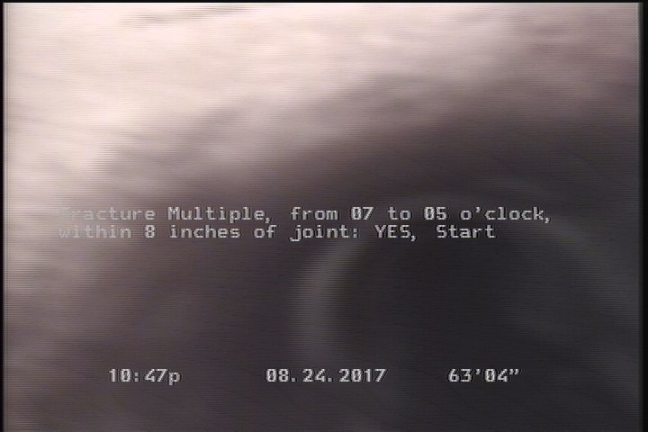 Fracture Multiple, from 07 to 05 o'clock, within 8 inches of joint: YES, Start