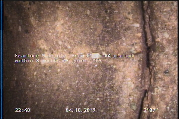 Fracture Multiple, from 01 to 04 o'clock, within 8 inches of joint: YES
