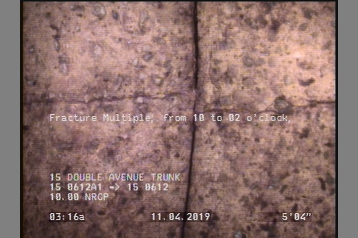 Fracture Multiple, from 10 to 02 o'clock, within 8 inches of joint: NO, Start