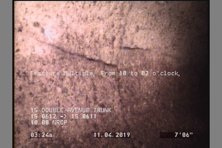 Fracture Multiple, from 10 to 02 o'clock, within 8 inches of joint: YES, Start