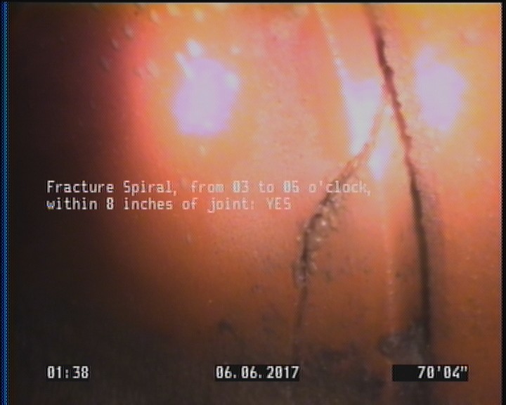Fracture Spiral, from 03 to 05 o'clock, within 8 inches of joint: YES