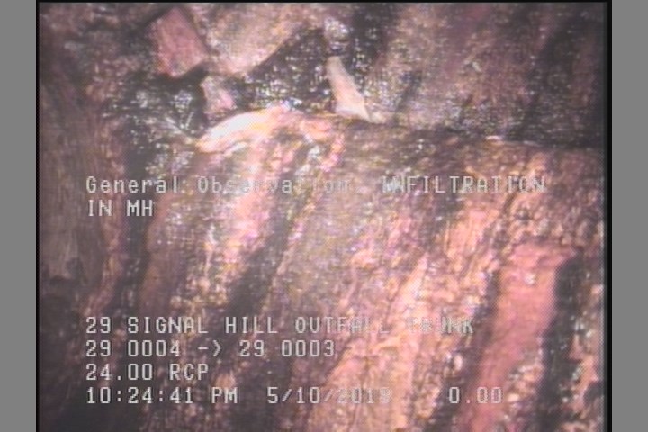 General Observation - INFILTRATION IN MH