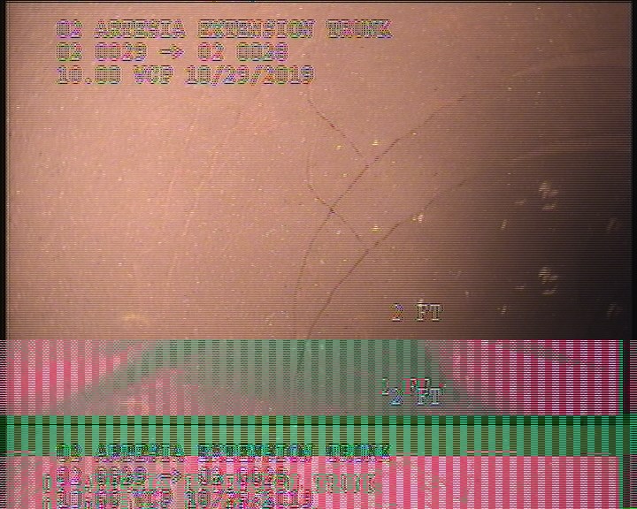 Fracture Multiple, from 07 to 06 o'clock, within 8 inches of joint: YES, - SLIGHT