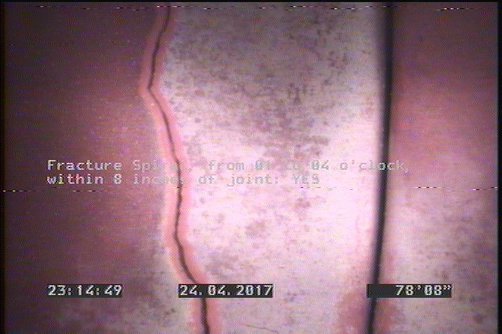 Fracture Spiral, from 01 to 04 o'clock, within 8 inches of joint: YES