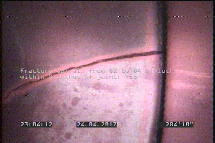 Fracture Spiral, from 02 to 04 o'clock, within 8 inches of joint: YES