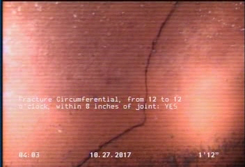 Fracture Circumferential, from 12 to 12 o'clock, within 8 inches of joint: YES