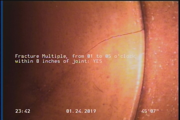 Fracture Multiple, from 01 to 05 o'clock, within 8 inches of joint: YES